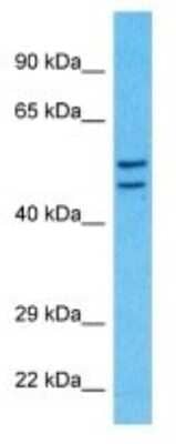 Western Blot: CEP57 Antibody [NBP3-10779] - Western blot analysis of CEP57 in Fetal Liver lysates. Antibody dilution at 1.0ug/ml