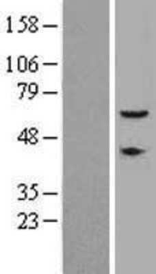 Western Blot CEP57 Overexpression Lysate