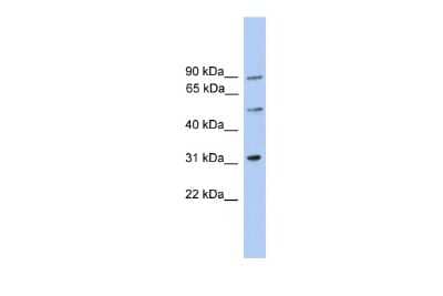 Western Blot: CEP57L1 Antibody [NBP2-84654] - WB Suggested Anti-C6orf182 Antibody Titration: 0.2-1 ug/ml. ELISA Titer: 1:312500. Positive Control: Jurkat cell lysate