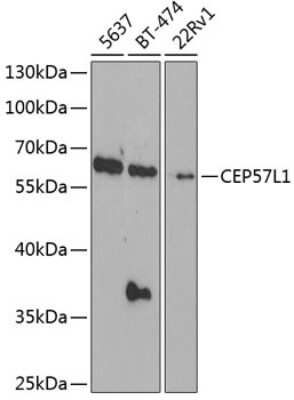 Western Blot: CEP57L1 Antibody [NBP2-92923] - Analysis of extracts of various cell lines, using CEP57L1 at 1:1000 dilution.Secondary antibody: HRP Goat Anti-Rabbit IgG (H+L) at 1:10000 dilution.Lysates/proteins: 25ug per lane.Blocking buffer: 3% nonfat dry milk in TBST.Detection: ECL Basic Kit .Exposure time: 90s.