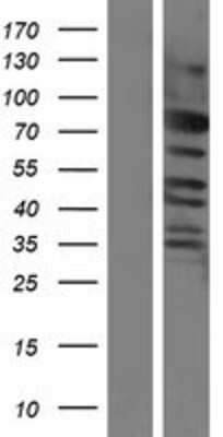 Western Blot: CEP57L1 Overexpression Lysate (Adult Normal) [NBP2-05107] Left-Empty vector transfected control cell lysate (HEK293 cell lysate); Right -Over-expression Lysate for CEP57L1.