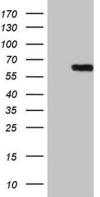 Western Blot: CEP63 Antibody (OTI2H2) - Azide and BSA Free [NBP2-72221] - HEK293T cells were transfected with the pCMV6-ENTRY control (Left lane) or pCMV6-ENTRY CEP63 (Right lane) cDNA for 48 hrs and lysed. Equivalent amounts of cell lysates (5 ug per lane) were separated by SDS-PAGE and immunoblotted with anti-CEP63.