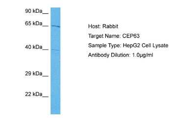 Western Blot: CEP63 Antibody [NBP2-84656] - Host: Rabbit. Target Name: CEP63. Sample Tissue: Human HepG2 Whole Cell lysates. Antibody Dilution: 1ug/ml