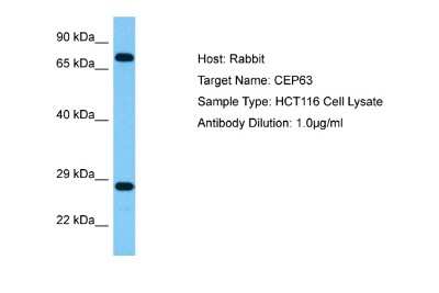 Western Blot: CEP63 Antibody [NBP2-84657] - Host: Rabbit. Target Name: CEP63. Sample Tissue: Human HCT116 Whole Cell lysates. Antibody Dilution: 1ug/ml