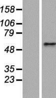 Western Blot: CEP63 Overexpression Lysate (Adult Normal) [NBP2-08357] Left-Empty vector transfected control cell lysate (HEK293 cell lysate); Right -Over-expression Lysate for CEP63.