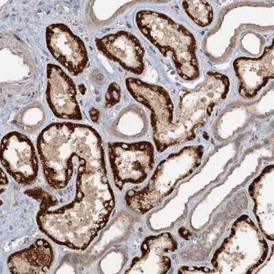 Immunohistochemistry-Paraffin: CEP68 Antibody [NBP1-82988] - Staining of human kidney shows strong cytoplasmic positivity in cells in tubules.