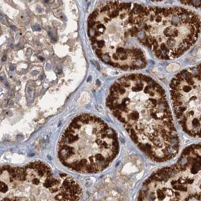 Immunohistochemistry-Paraffin: CEP68 Antibody [NBP1-82988] - Staining of human kidney.