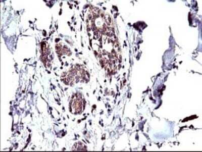Immunohistochemistry CEP68 Antibody (OTI5B4)