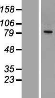 Western Blot: CEP68 Overexpression Lysate (Adult Normal) [NBL1-09103] Left-Empty vector transfected control cell lysate (HEK293 cell lysate); Right -Over-expression Lysate for CEP68.