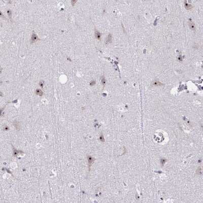 Immunohistochemistry-Paraffin CEP72 Antibody - BSA Free