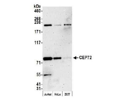 Western Blot CEP72 Antibody