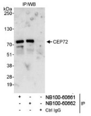 Western Blot: CEP72 Antibody [NB100-60662] - Detection of Human CEP72 on HeLa whole cell lysate using NB100-60662. CEP72 was also immunoprecipitated by rabbit anti-CEP72 antibody NB100-60661.