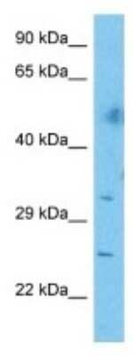 Western Blot: CEP72 Antibody [NBP3-10639] - Western blot analysis of CEP72 in Human Thymus Tumor. Antibody dilution at 1 ug/mL