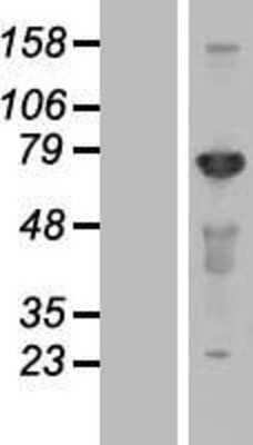 Western Blot: CEP72 Overexpression Lysate (Adult Normal) [NBL1-09105] Left-Empty vector transfected control cell lysate (HEK293 cell lysate); Right -Over-expression Lysate for CEP72.