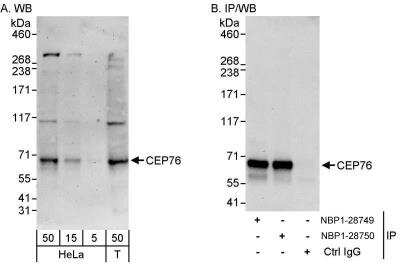 Western Blot CEP76 Antibody