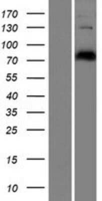 Western Blot CEP78 Overexpression Lysate