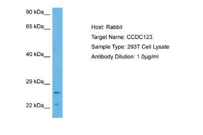 Western Blot: CEP89 Antibody [NBP2-84662] - Host: Rabbit. Target Name: CCDC123. Sample Tissue: Human 293T Whole Cell lysates. Antibody Dilution: 1ug/ml