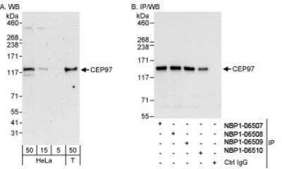Western Blot: CEP97 Antibody [NBP1-06508] - Whole cell lysate from HeLa and 293T cells. CEP97 was also immunoprecipitated by rabbit anti-CEP97 antibodies NBP1-06507, NBP1-06509 and NBP1-06510.
