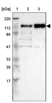 Western Blot: CEP97 Antibody [NBP1-83591] - Lane 1: Marker  [kDa] 220, 112, 84, 47, 32, 26, 17.  Lane 2: Human cell line RT-4.  Lane 3: Human cell line U-251MG sp