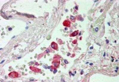 Immunohistochemistry-Paraffin: CES1 Antibody [NBP1-00167] - (2.5ug/ml) staining of paraffin embedded Human Lung. Steamed antigen retrieval with citrate buffer pH 6, AP-staining.