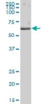 Western Blot: Carboxylesterase 1/CES1 Antibody [H00001066-B01P] - Analysis of CES1 expression in human liver.