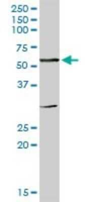 Western Blot: Carboxylesterase 1/CES1 Antibody [H00001066-D01P] - Analysis of CES1 expression in human placenta.