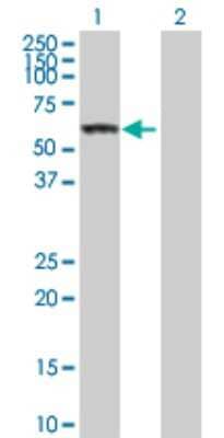 Western Blot: Carboxylesterase 1/CES1 Antibody [H00001066-D01P] - Analysis of CES1 expression in transfected 293T cell line by CES1 polyclonal antibody.Lane 1: CES1 transfected lysate(62.30 KDa).Lane 2: Non-transfected lysate.