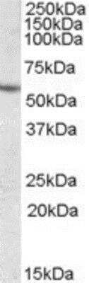 Western Blot: CES1 Antibody [NBP1-00167] - Analysis of CES1 in Human Liver lysate (35ug protein in RIPA buffer) using NBP1-00167 at 0.3ug/ml. Primary incubation was 1 hour. Detected by chemiluminescence.