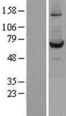 Western Blot: Carboxylesterase 1/CES1 Overexpression Lysate (Native) [NBL1-09112] - Left-Empty vector transfected control cell lysate (HEK293 cell lysate); Right -Over-expression Lysate for CES1.