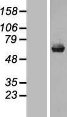 Western Blot: Carboxylesterase 1/CES1 Overexpression Lysate (Native) [NBL1-09113] - Left-Empty vector transfected control cell lysate (HEK293 cell lysate); Right -Over-expression Lysate for CES1.