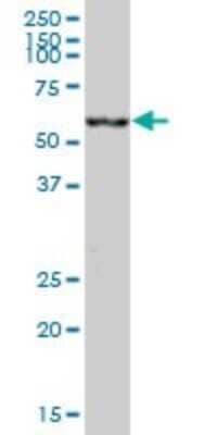 Western Blot: CES2 Antibody [H00008824-B01P] - Analysis of CES2 expression in human liver.
