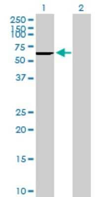 Western Blot: CES2 Antibody [H00008824-B01P] - Analysis of CES2 expression in transfected 293T cell line by CES2 polyclonal antibody.  Lane1:CES2 transfected lysate(68.53 KDa). Lane2:Non-transfected lysate.