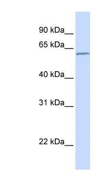 Western Blot: CES7 Antibody [NBP1-70498] - HepG2 cell lysate, concentration 0.2-1 ug/ml.