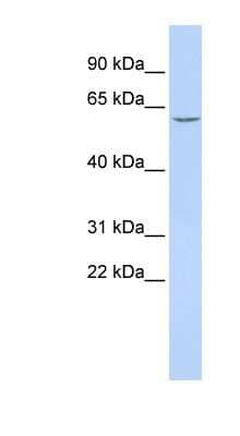 Western Blot CES7 Antibody - BSA Free