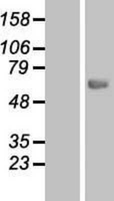 Western Blot: CES7 Overexpression Lysate (Adult Normal) [NBP2-05514] Left-Empty vector transfected control cell lysate (HEK293 cell lysate); Right -Over-expression Lysate for CES7.