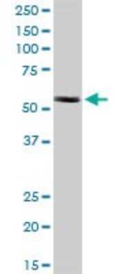 Western Blot: CESK1 Antibody [H00150160-B01P] - Analysis of CCT8L2 expression in A-431.