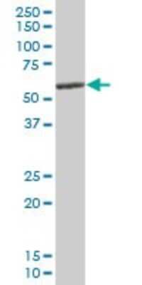 Western Blot: CESK1 Antibody [H00150160-B01P] - Analysis of CESK1 expression in human liver.