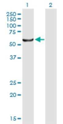 Western Blot: CESK1 Antibody [H00150160-B01P] - Analysis of CCT8L2 expression in transfected 293T cell line by CCT8L2 polyclonal antibody.  Lane 1: CESK1 transfected lysate(61.27 KDa). Lane 2: Non-transfected lysate.