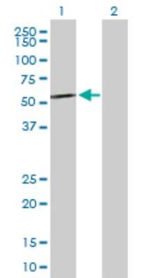 Western Blot: CESK1 Antibody [H00150160-D01P] - Analysis of CCT8L2 expression in transfected 293T cell line by CCT8L2 polyclonal antibody.Lane 1: CCT8L2 transfected lysate(59.40 KDa).Lane 2: Non-transfected lysate.