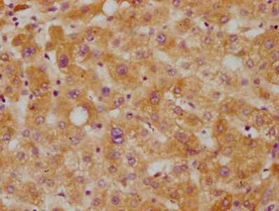 Immunohistochemistry: CETP Antibody (2F1) [NBP3-15191] - IHC image of  CETP antibody diluted at 1:115 and staining in paraffin-embedded human liver tissue. After dewaxing and hydration, antigen retrieval was mediated by high pressure in a citrate buffer (pH 6.0). Section was blocked with 10% normal goat serum 30 minutes at RT. Then primary antibody (1% BSA) was incubated at 4C overnight. The primary is detected by a biotinylated secondary antibody and visualized using an HRP conjugated SP system.