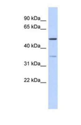 Western Blot: CETP Antibody [NBP1-57982] - Titration: 0.2-1 ug/ml, Positive Control: Human Thymus.