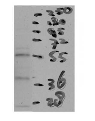 Western Blot: CETP Antibody [NBP1-57982] - Human Muscle lysate at 1:1000.