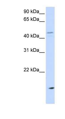 Western Blot: CETP Antibody [NBP1-58015] - MCF-7 whole cell lysates, concentration 0.2-1 ug/ml.