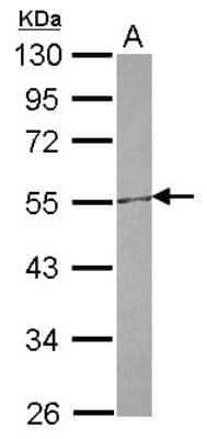 Western Blot: CETP Antibody [NBP2-15867] - Sample (30 ug of whole cell lysate) A: HepG2 10% SDS PAGE gel, diluted at 1:500.