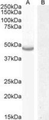 Western Blot: CETP Antibody [NBP3-11019] - Staining of HepG2 cell lysate (A) and Negative control Caco-2 cell lysate (B) (35 ug protein in RIPA buffer). Antibody at 0.3 ug/mL. Detected by chemiluminescence.