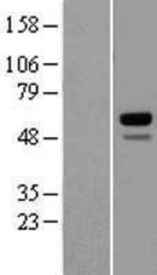 Western Blot: CETP Overexpression Lysate (Adult Normal) [NBL1-09118] Left-Empty vector transfected control cell lysate (HEK293 cell lysate); Right -Over-expression Lysate for CETP.