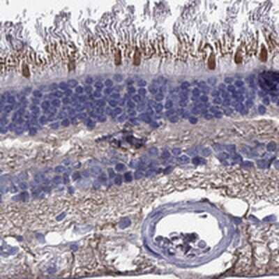 Immunohistochemistry-Paraffin: CFAP161 Antibody [NBP3-17227] - Staining of human retina shows strong cytoplasmic positivity in cones and nerve fibers.