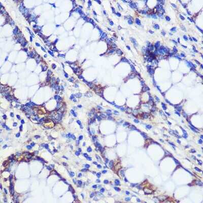 Immunohistochemistry-Paraffin: CFAP61 Antibody [NBP2-92398] - Immunohistochemistry of paraffin-embedded Human colon using CFAP61 Rabbit pAb (NBP2-92398) at dilution of 1:100 (40x lens). Perform microwave antigen retrieval with 10 mM PBS buffer pH 7.2 before commencing with IHC staining protocol.