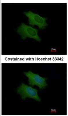 Immunocytochemistry/Immunofluorescence: CFHL1 Antibody [NBP2-15868] - Immunofluorescence analysis of methanol-fixed HeLa, using antibody at 1:200 dilution.