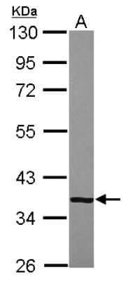 Western Blot: CFHL1 Antibody [NBP2-15868] - Sample (30 ug of whole cell lysate) A: A549 10% SDS PAGE gel, diluted at 1:1000.